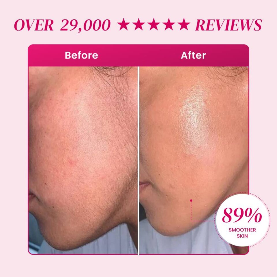 EpiBella image